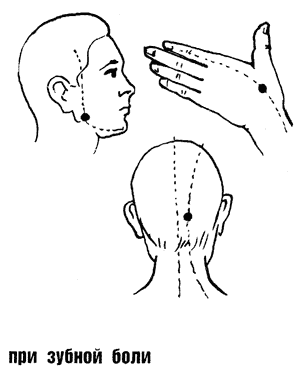Зубная точка. Бальзам Золотая Звездочка при зубной боли. Вьетнамский бальзам Звездочка при головной боли. Бальзам Звездочка точки нанесения схема. Акупунктура бальзамом Золотая звезда.